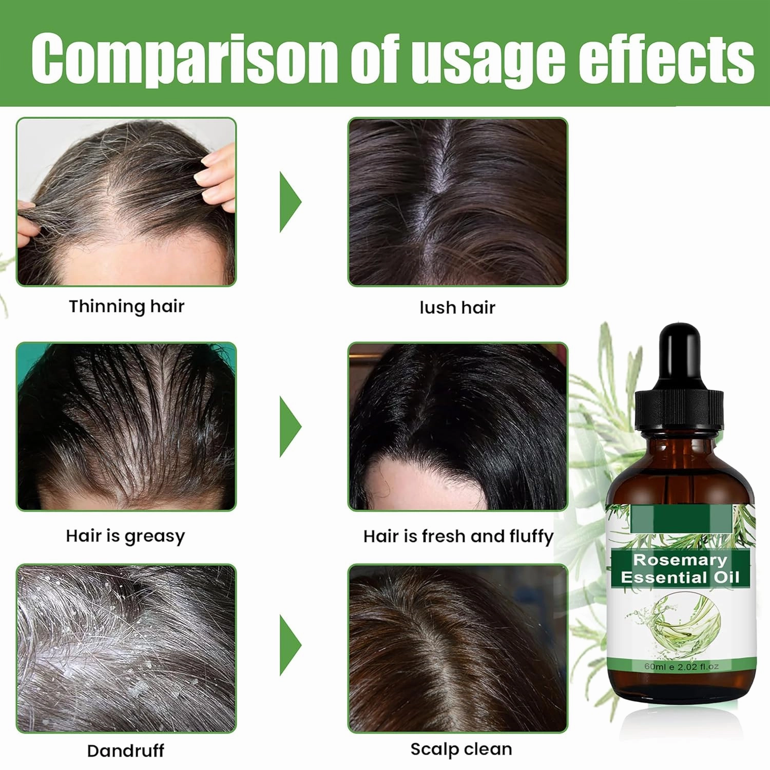 Aceite de Romero Para, Aceite de Romero Para el Crecimiento Del Cabello, Aceite de Ricino para Cejas y Pestañas y Cuidado de la Piel 6.0 FI OZ/180ML