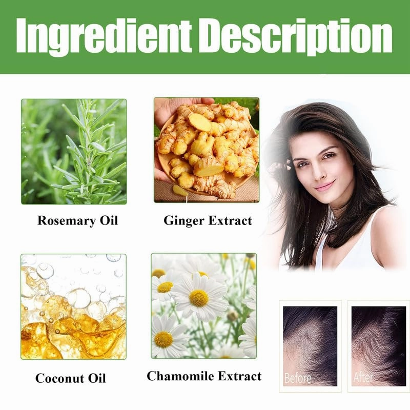 Aceite de Romero Para el Crecimiento Del Cabello, Ricino Para Cejas, Pestaas y Cuidado de la Piel - 1 Masajeador - 4.0 FI OZ/120ML