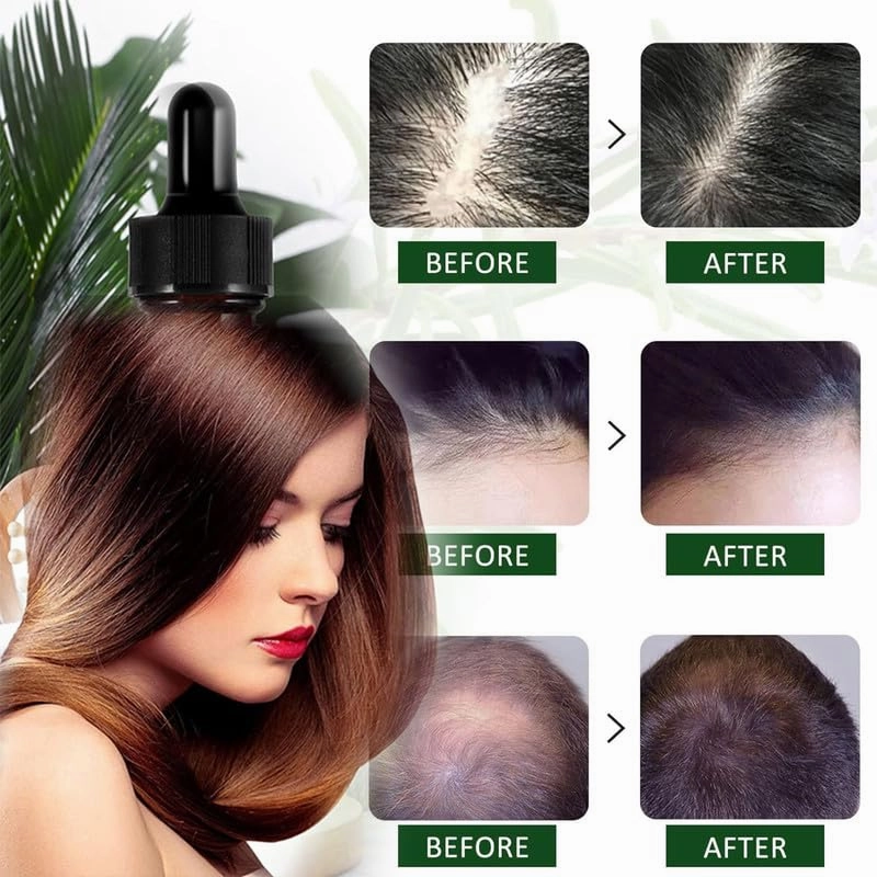 Aceite de Romero Para el Crecimiento Del Cabello, Ricino Para Cejas, Pestaas y Cuidado de la Piel - 1 Masajeador - 4.0 FI OZ/120ML