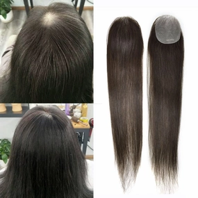 Bald Spot Hair Patch Toupee for Women Men Full Skin Base Human Hair Patch for Bald Spot Non-Surgical V-Looped Hair Replacement Black Brown Hairpiece 14" #1B Off Black-100% density