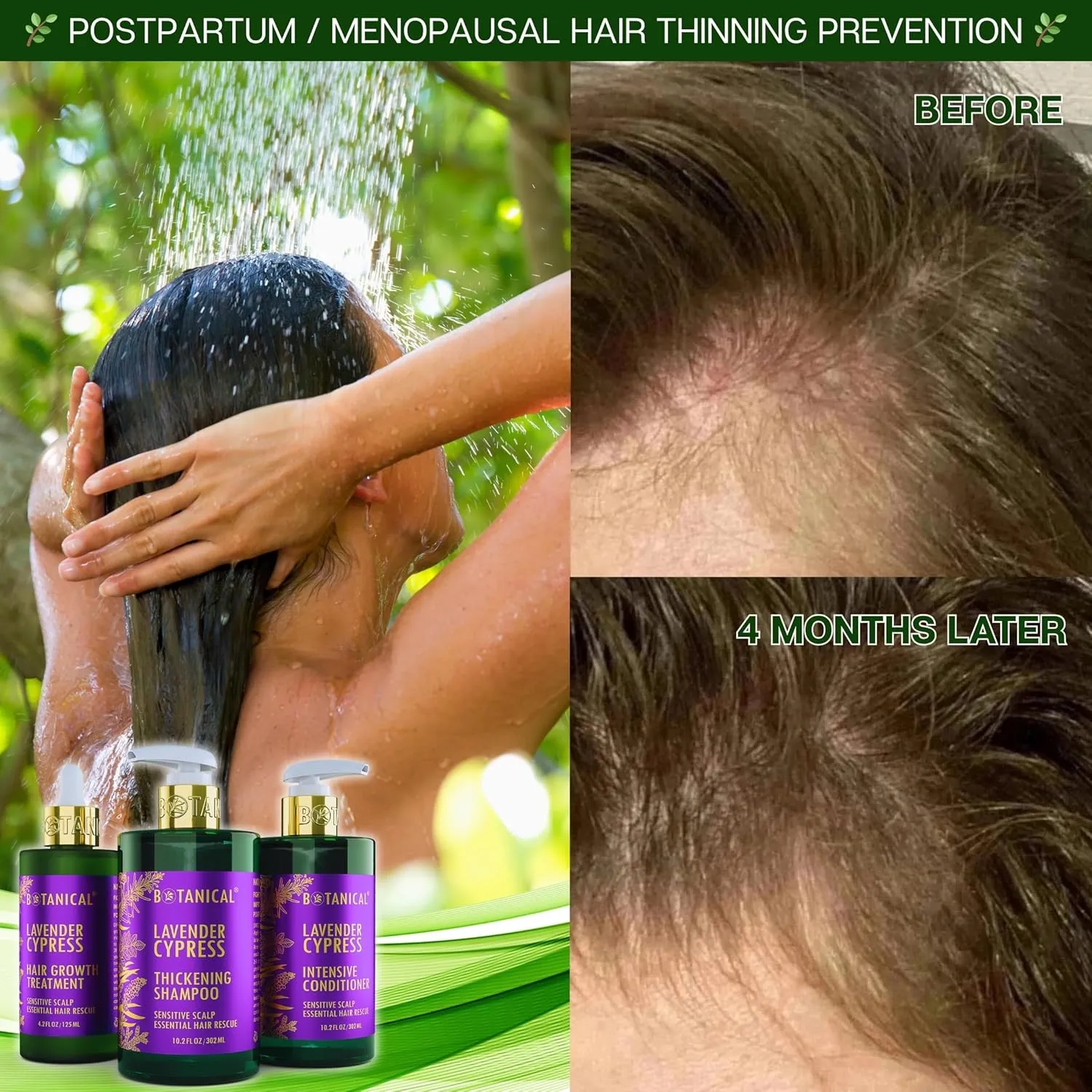 Botanical Hair Growth Lavender Shampoo with Saw Palmetto for Hair Loss and Hair Thinning Prevention Scalp Stimulating Natural Thickening Shampoo Regrowth Products For Women & Men 10.2 Fl Oz