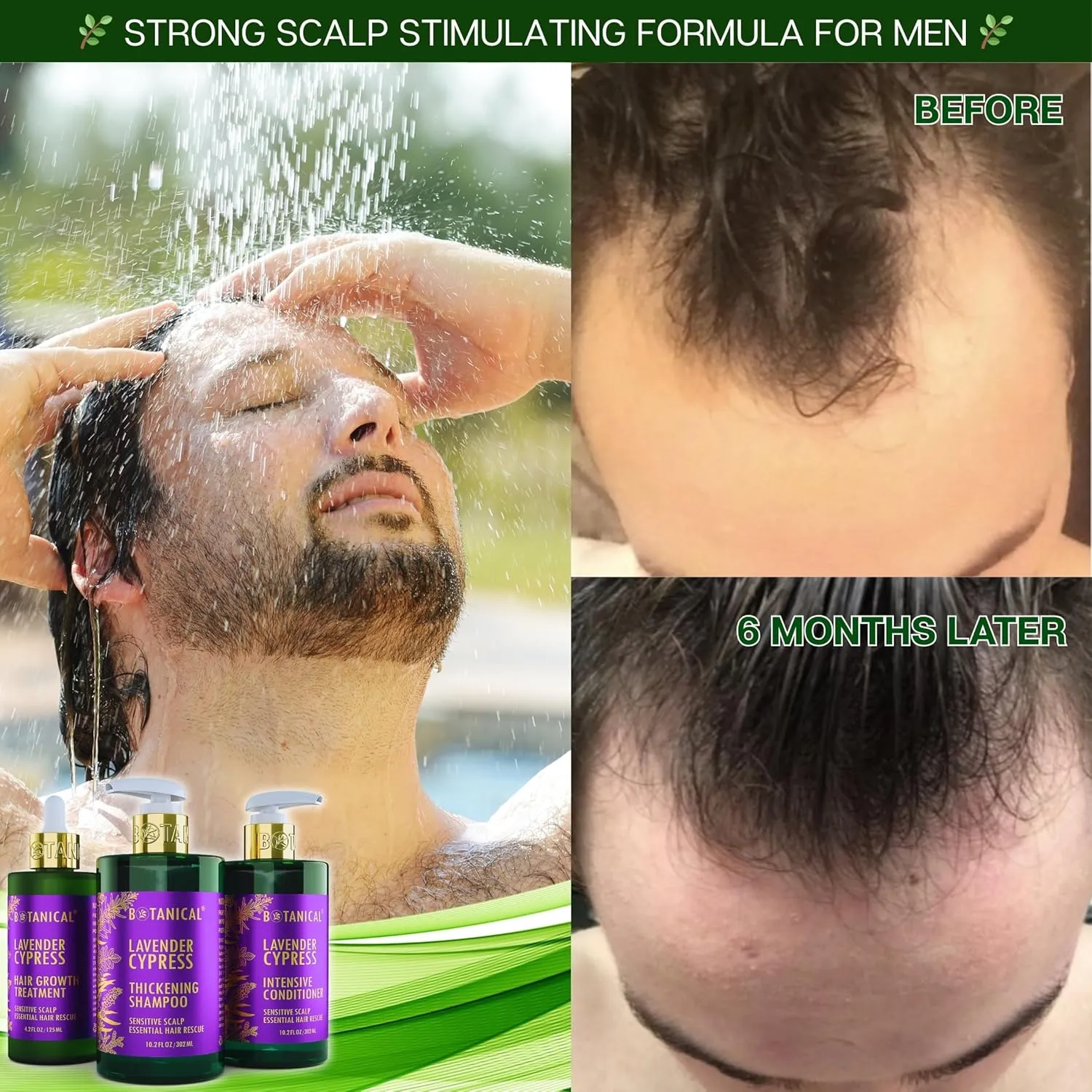 Botanical Hair Growth Lavender Shampoo with Saw Palmetto for Hair Loss and Hair Thinning Prevention Scalp Stimulating Natural Thickening Shampoo Regrowth Products For Women & Men 10.2 Fl Oz
