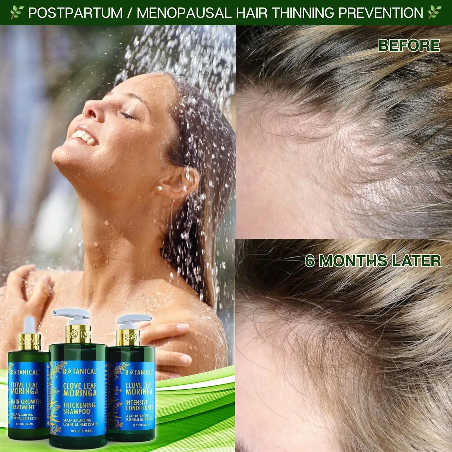 Botanical Hair Growth Moringa Shampoo With Saw Palmetto For Hair Loss and Hair Thinning Prevention Scalp Balancing Natural Thickening Shampoo Regrowth Products For Women & Men 10.2 Fl Oz