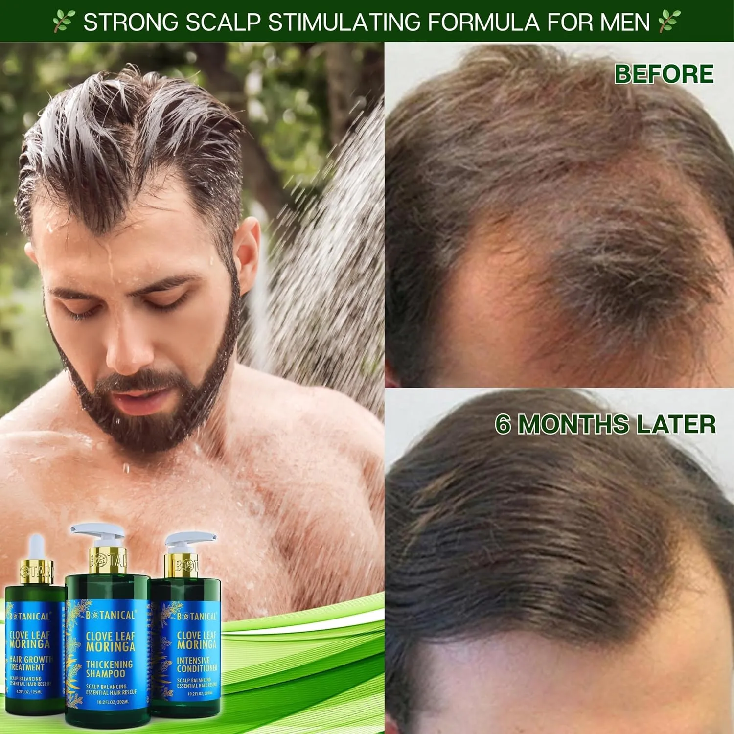 Botanical Hair Growth Moringa Shampoo With Saw Palmetto For Hair Loss and Hair Thinning Prevention Scalp Balancing Natural Thickening Shampoo Regrowth Products For Women & Men 10.2 Fl Oz