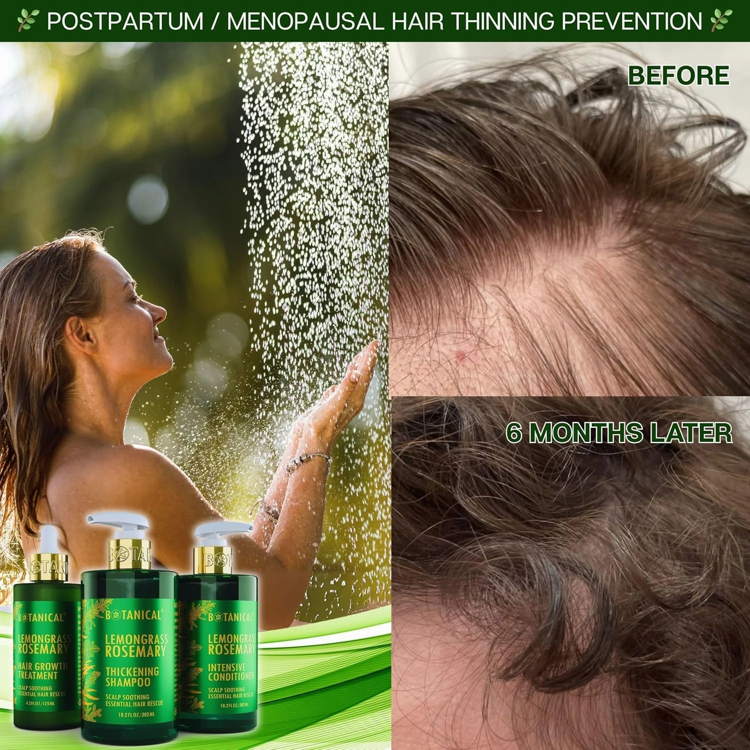 Botanical Hair Growth Rosemary Shampoo with Saw Palmetto for Hair Loss and Hair Thinning Prevention Scalp Soothing Natural Thickening Shampoo Regrowth Products For Women & Men 10.2 Fl Oz