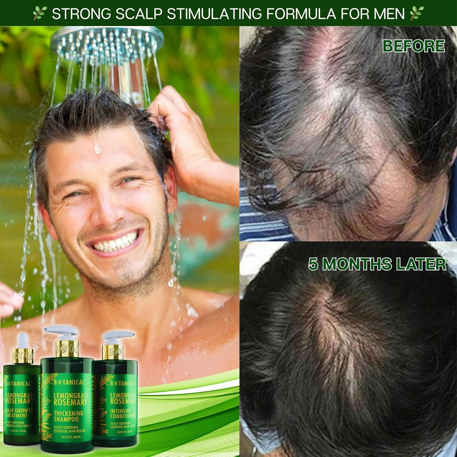 Botanical Hair Growth Rosemary Shampoo with Saw Palmetto for Hair Loss and Hair Thinning Prevention Scalp Soothing Natural Thickening Shampoo Regrowth Products For Women & Men 10.2 Fl Oz