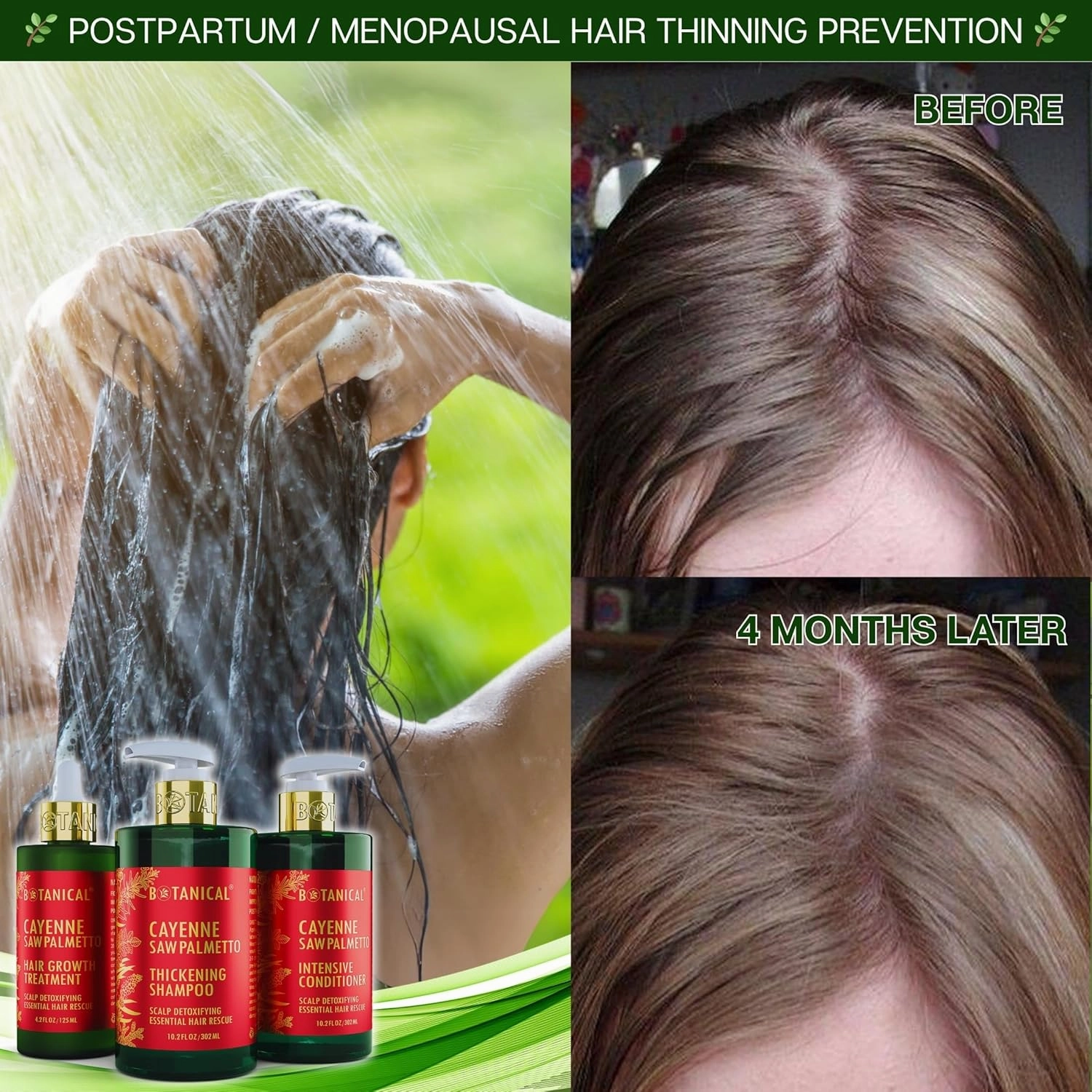Botanical Hair Growth Treatment - Scalp Detoxifying Cayenne Saw Palmetto Oil with Biotin for Anti-Thinning, Thickening Pre-Shampoo for Women & Men 4.2 Fl Oz