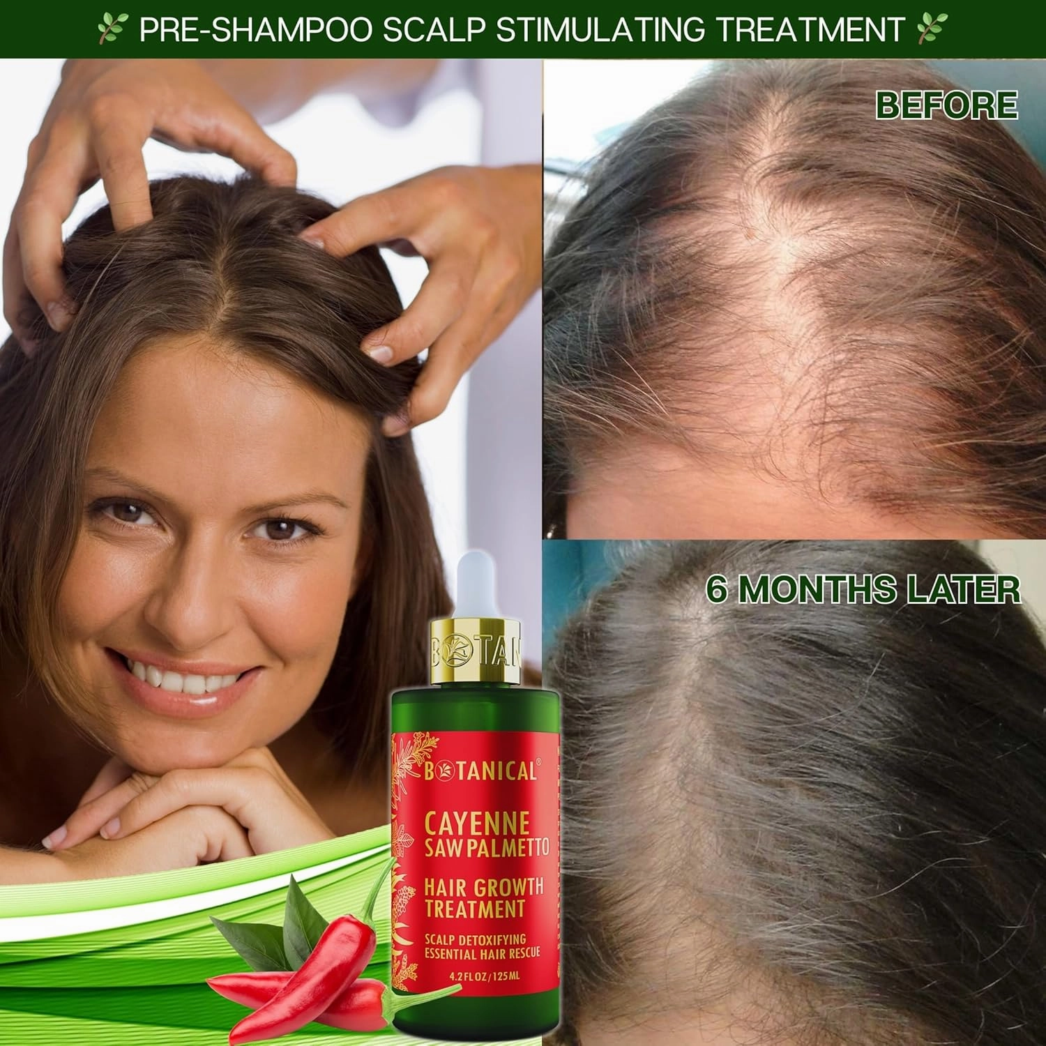 Botanical Hair Growth Treatment - Scalp Detoxifying Cayenne Saw Palmetto Oil with Biotin for Anti-Thinning, Thickening Pre-Shampoo for Women & Men 4.2 Fl Oz