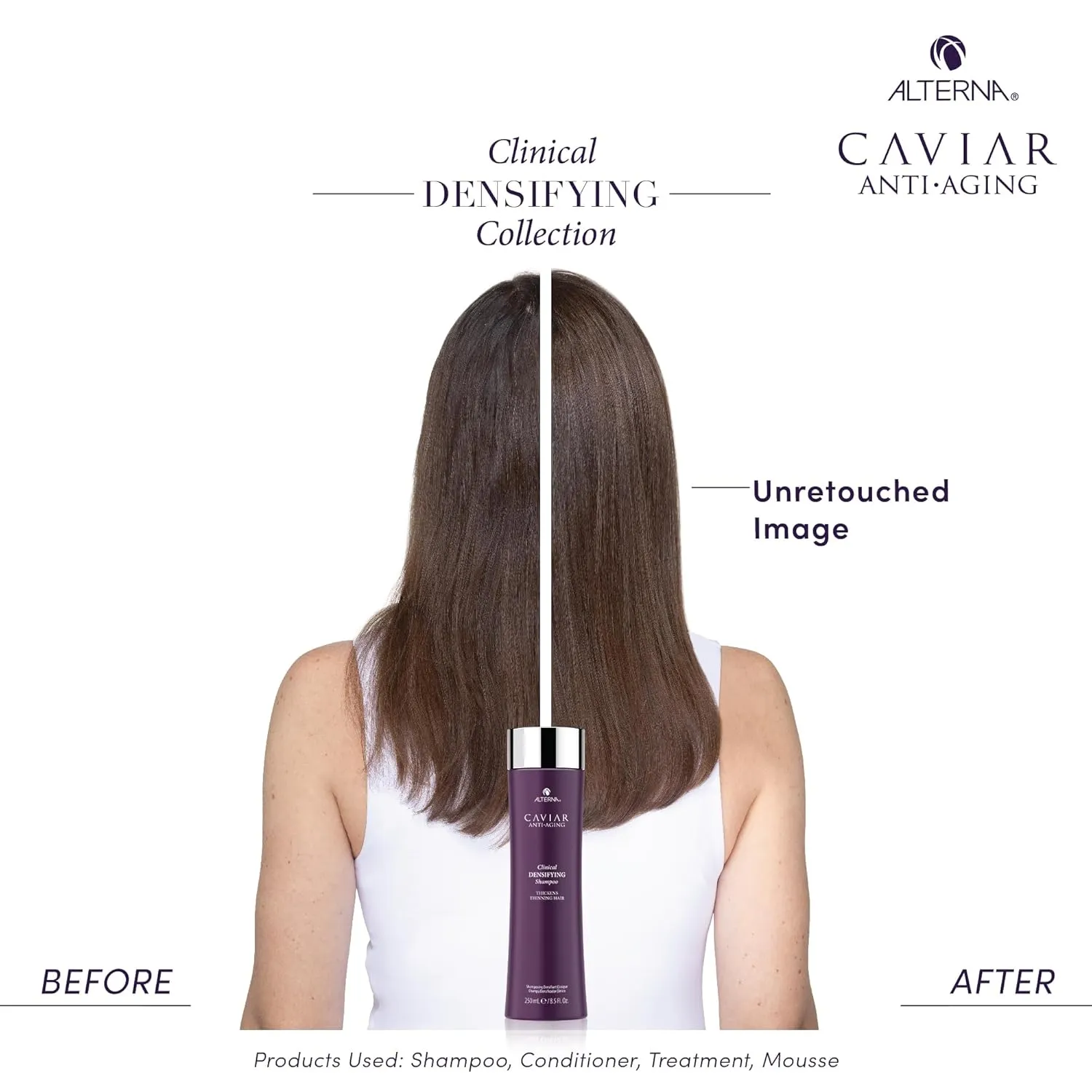 CAVIAR Anti-Aging Clinical Densifying Shampoo | For Fine, Thinning Hair | Thickens Hair, Protects Scalp | Sulfate Free