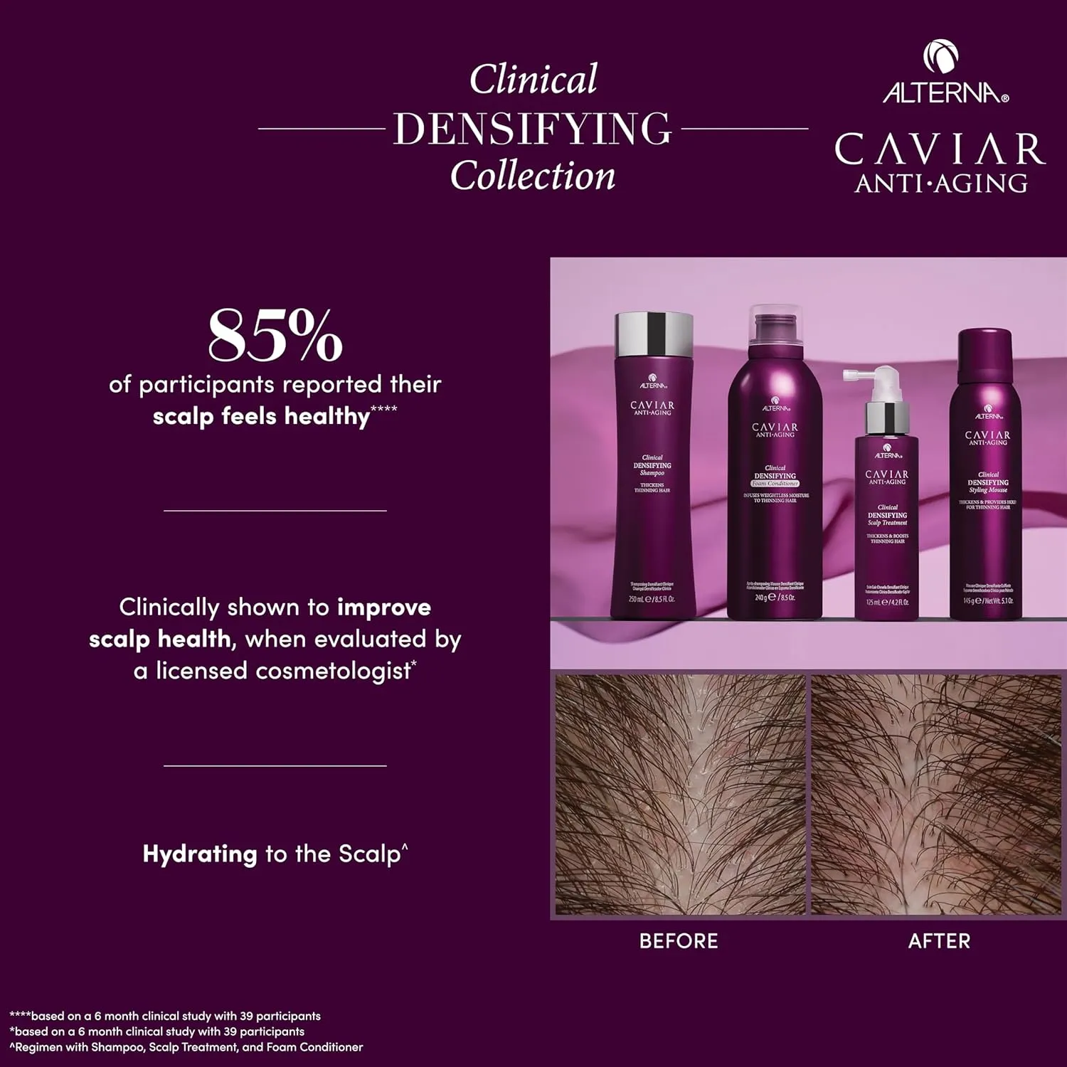 CAVIAR Anti-Aging Clinical Densifying Shampoo | For Fine, Thinning Hair | Thickens Hair, Protects Scalp | Sulfate Free