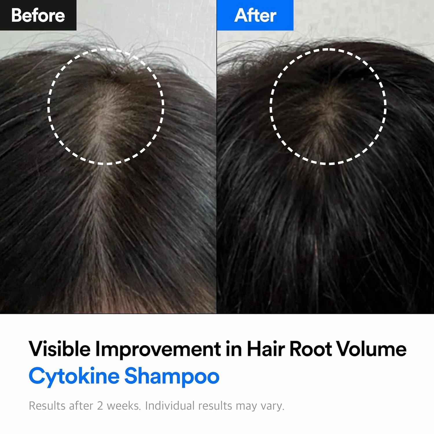 Hair-Recovery Cytokine Shampoo Plus Sensitive Care, 12.8 Fl. Oz. – Gentle Hair Loss Shampoo for Thinning Hair, Soothing Scalp Care, Hypoallergenic, Anti-Hair Fall, Sulfate-Free Formula for Fuller Hair