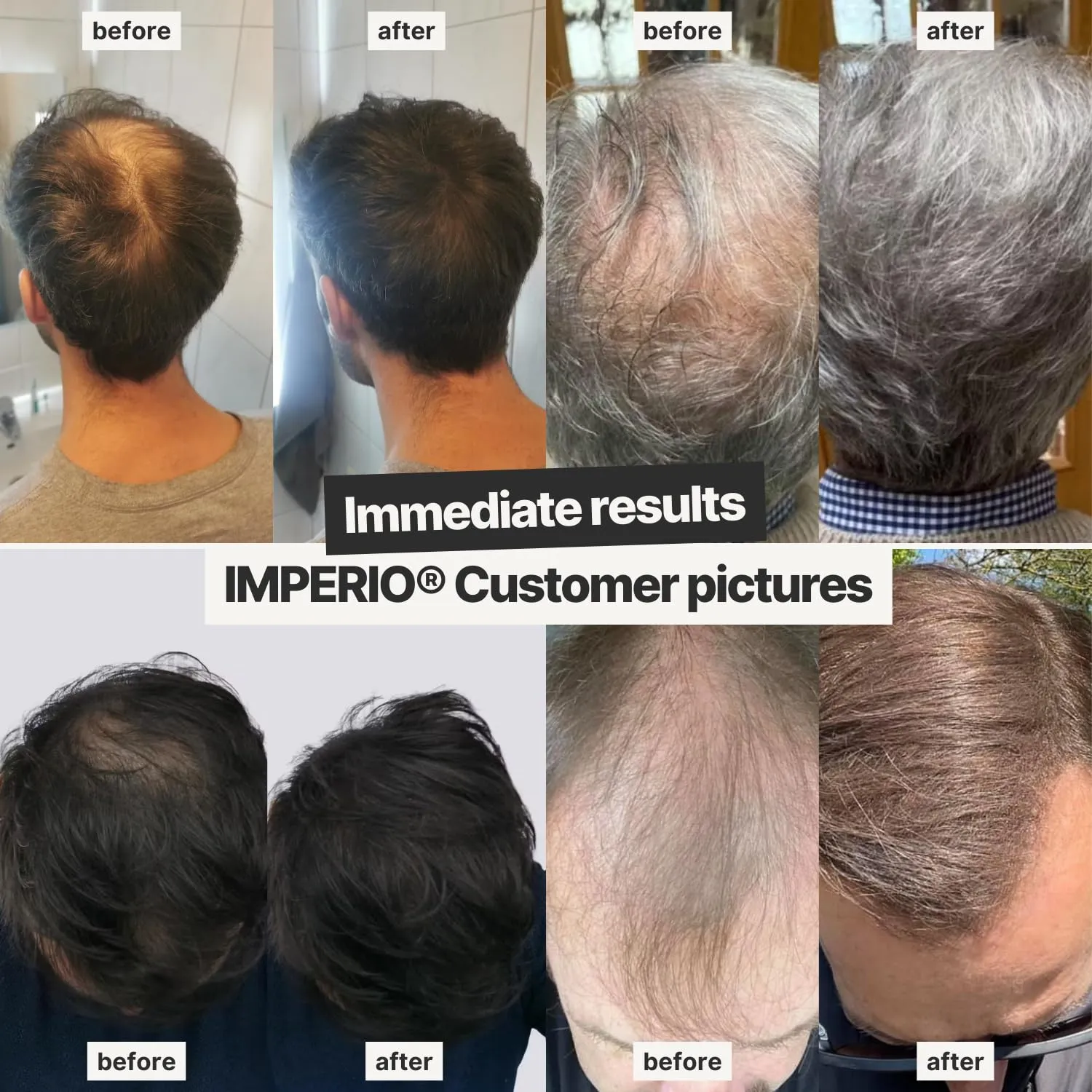 IMPERIO Hair Building Fibers for Thinning Hair - 26g Premium Hair Fibers for Women & Men in Hairdresser Quality - Hair thickening in less than 20 seconds (Light Blonde)