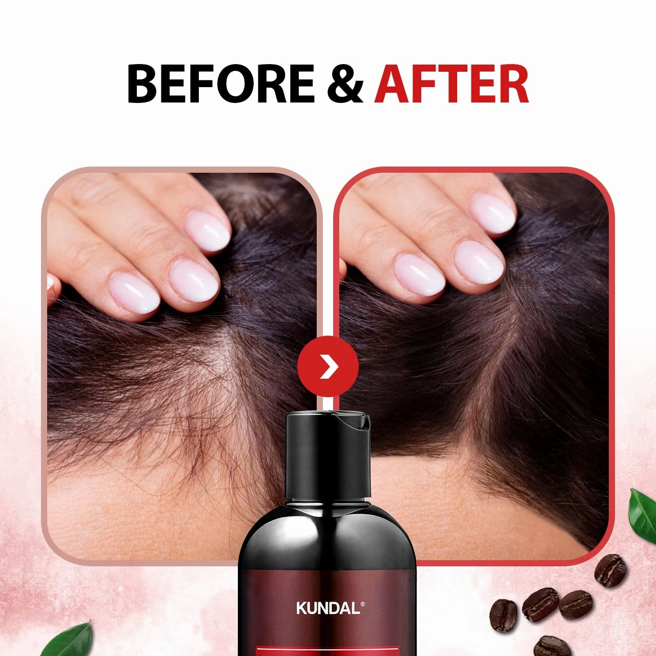 KUNDAL Official Caffeine Scalp Shampoo, 16.9 fl oz (500 ml), White Musk