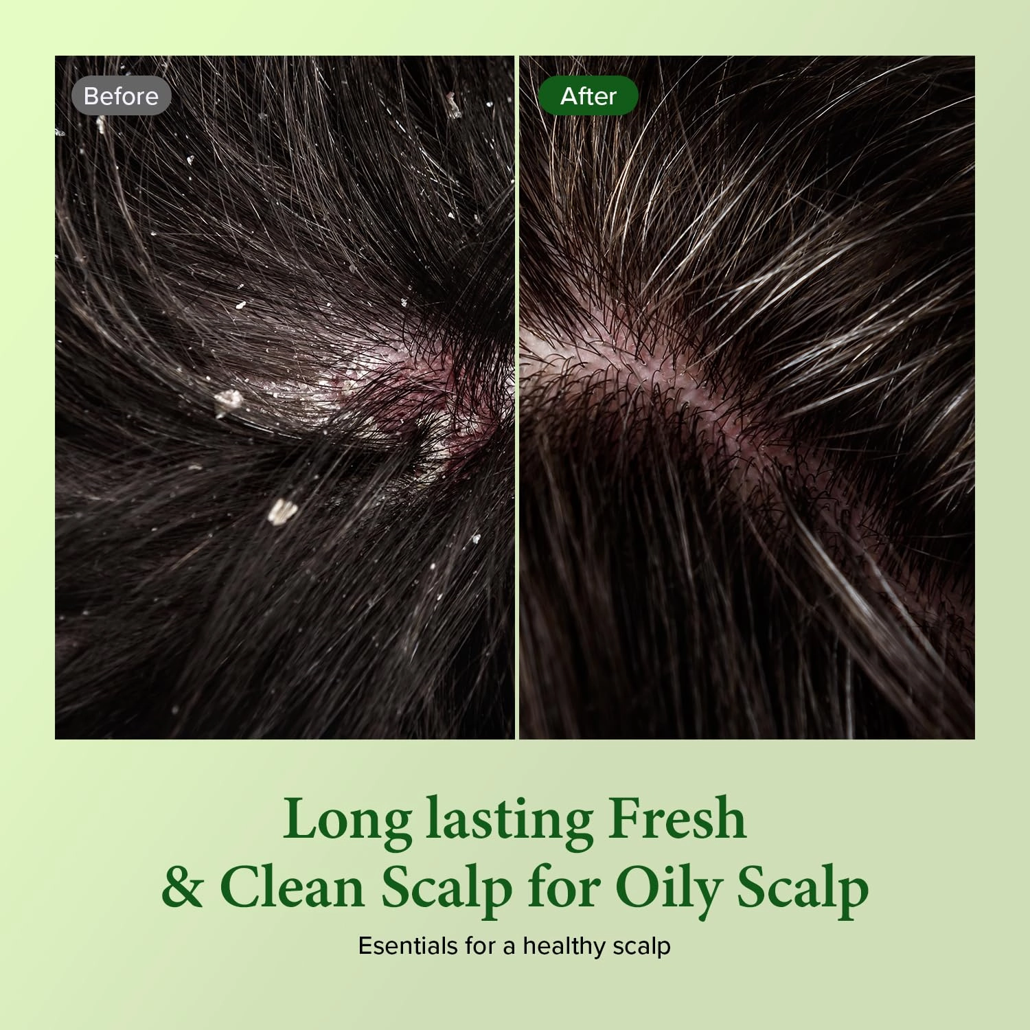KUNDAL Tea Tree & Macadamia Deep Cleansing Shampoo - Korean Hair Care, Scalp Care, Tea Tree extract, For All hair Types 10.14fl oz each (Pack of 2) (Jasmine Woody)