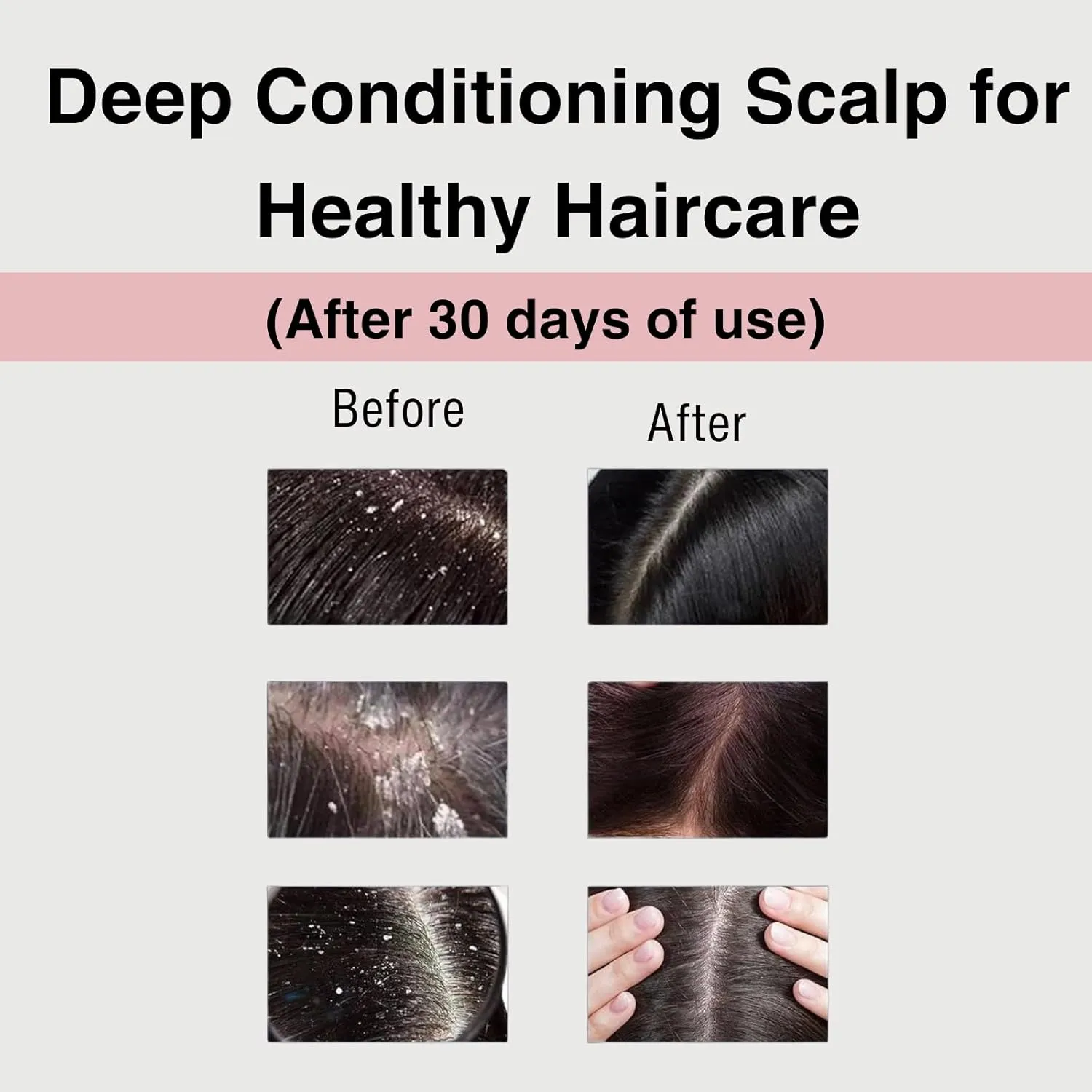 Moist Diane Keratin Shampoo and Conditioner Set for Curly Hair, Natural Argan Oil Shampoo & Conditioner, Silicone Free Shampoo for Women & Men from Japan, Paraben Free, EXTRA VITAL, 30.4 Fl Oz