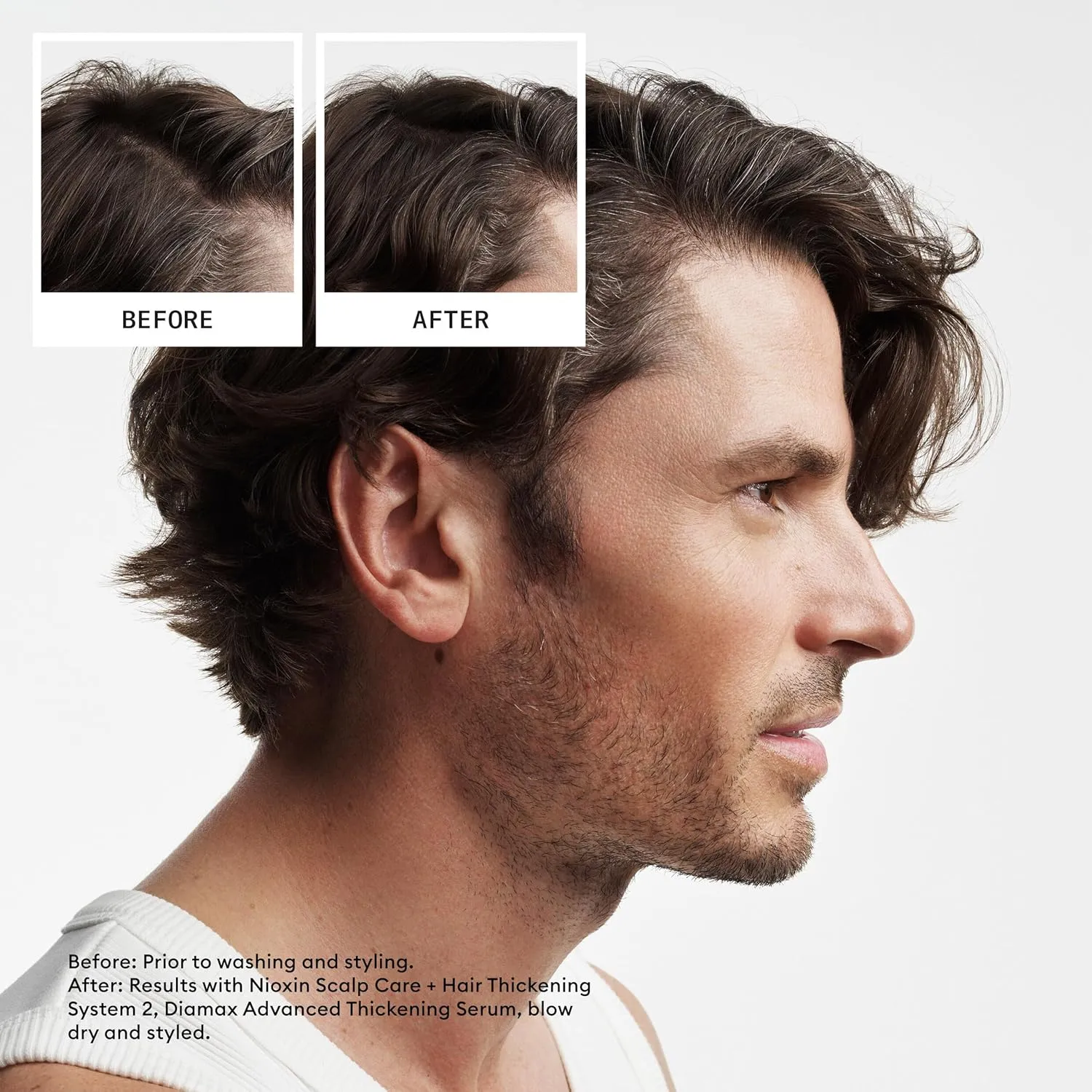 Nioxin System 2 Scalp   Hair Thickening Shampoo For Natural Hair with Progressed Thinning Boost Hair Density with Niacinamide & Biotin