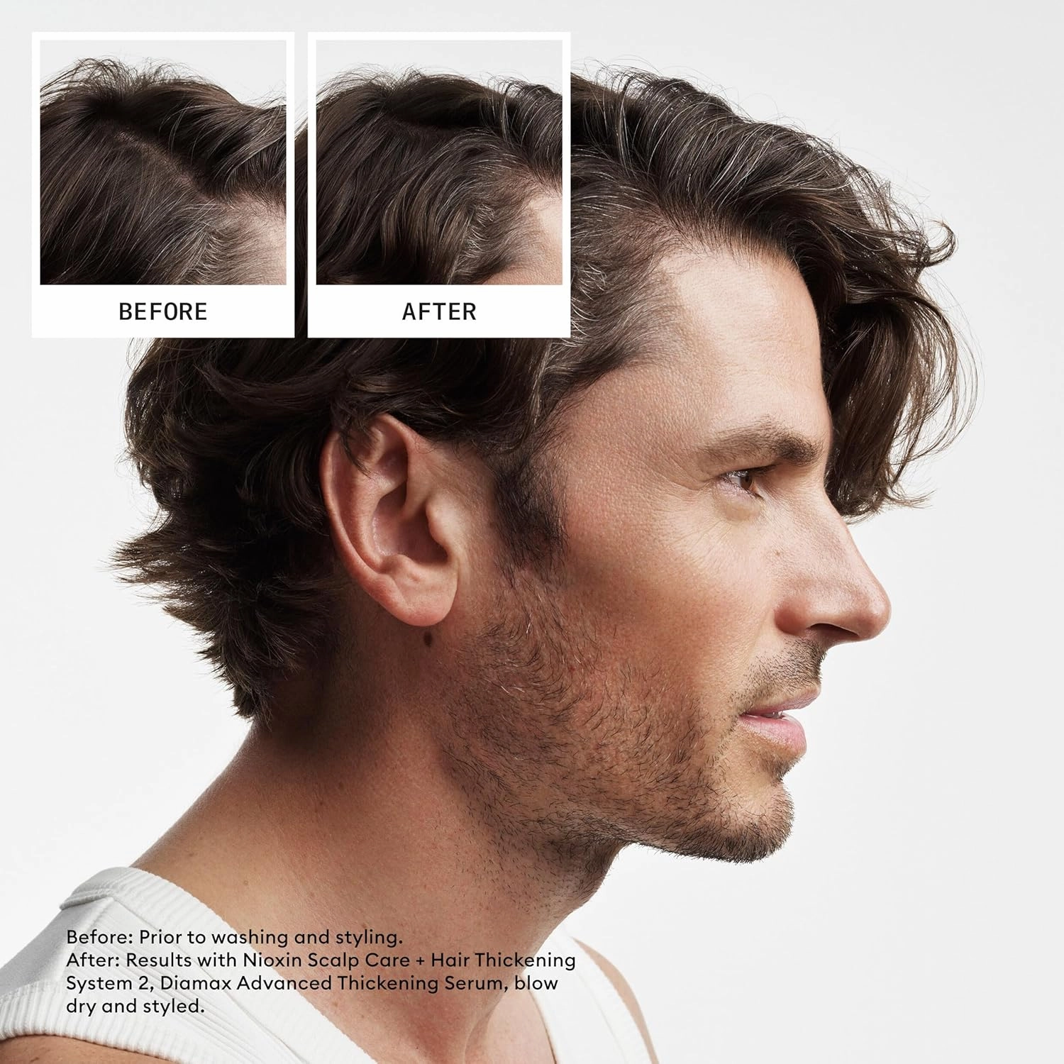 Nioxin System 2 Scalp   Hair Thickening Shampoo For Natural Hair with Progressed Thinning Boost Hair Density with Niacinamide & Biotin