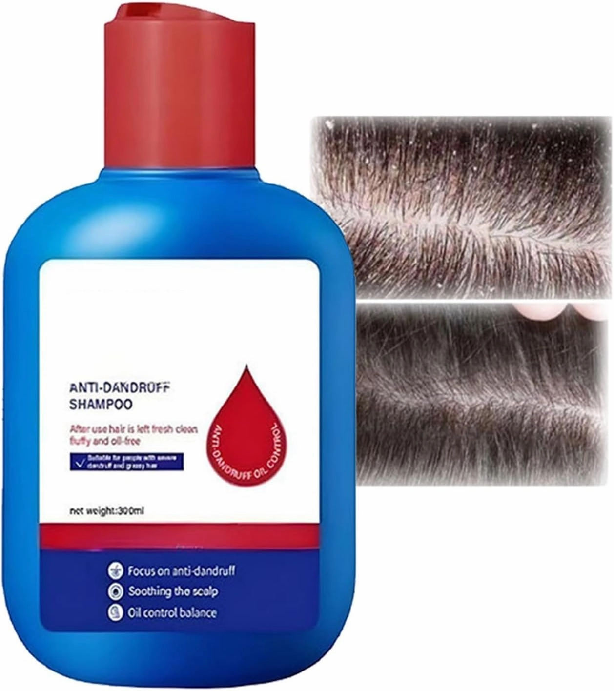 Nipori Shampoo, Hair Care Shampoo, Oil Control Refreshing Anti-Dandruff Cleansing for Men and Women