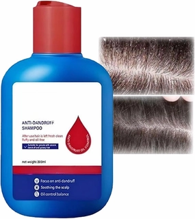 Nipori Shampoo, Hair Care Shampoo, Oil Control Refreshing Anti-Dandruff Cleansing for Men and Women