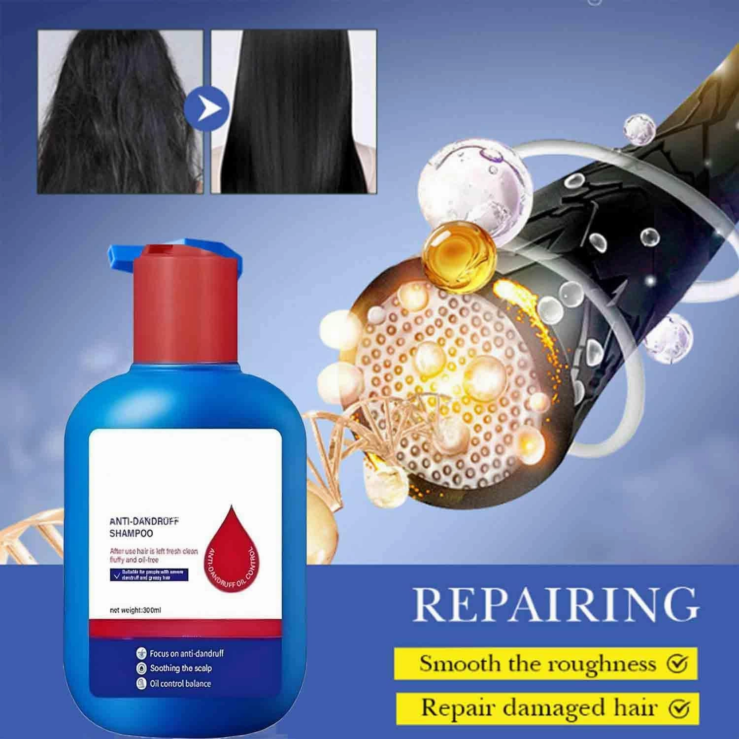 Nipori Shampoo, Nipori Shampoo Selenium, Refreshing Scalp Care, Hair Care Oil Control Refreshing Anti-Dandruff Cleansing, for Men and Women