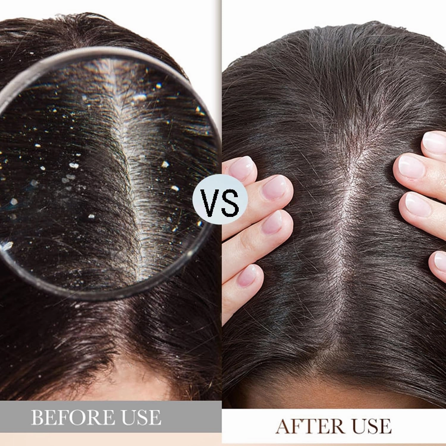 Nipori Shampoo,Nippori Anti-Dandruff,Hair Care Shampoo Oil Control Refreshing Anti-Dandruff Cleansing