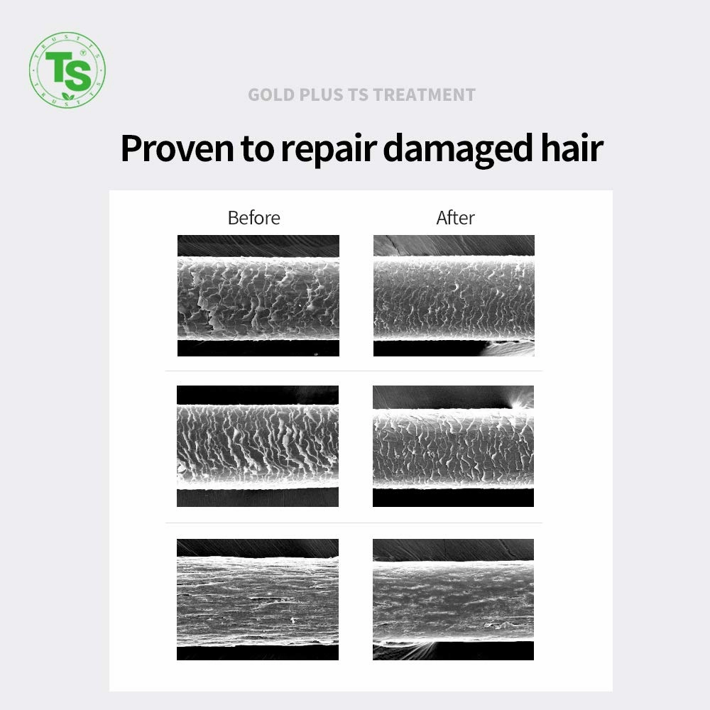 TS Gold Plus Treatment | Korean Hair Care Conditioner for Hair Loss & Sensitive Scalp | GP Complex & Organic Ingredients | Sulfate & Paraben Free (17.6 Fl Oz)