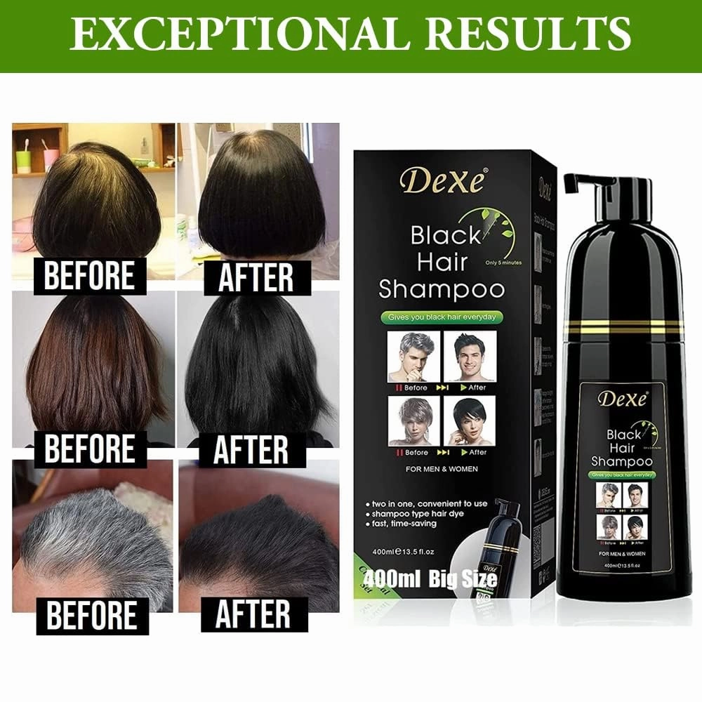 Vedora Instant Black Hair Shampoo 400ml - Semi-Permanent DeXe black Hair Dye shampoo for Natural Hair, Lasts 30 Days, Fast Acting Formula for Men & Women